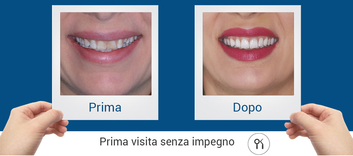 visita-senza-impegno